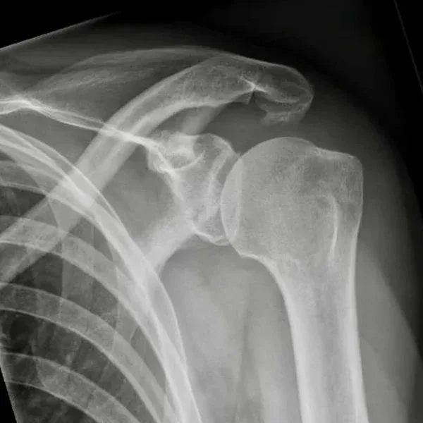 deltacore-pain4 Image